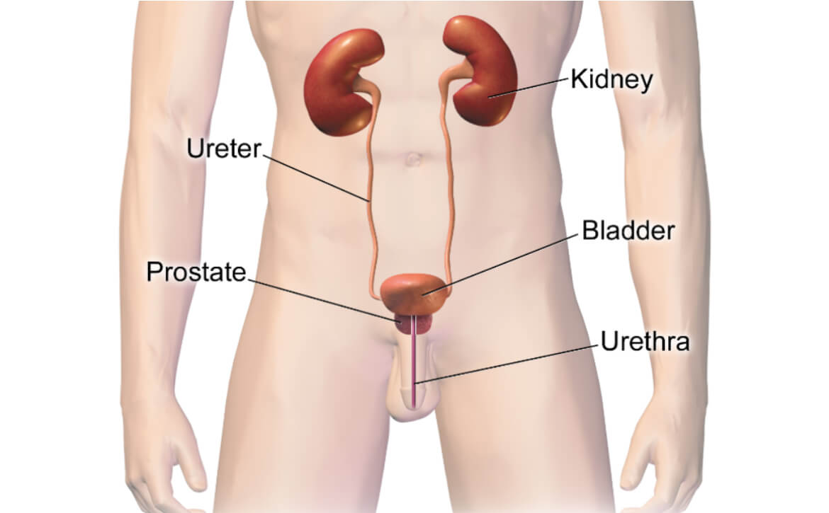 Urinary tract infection (UT!)